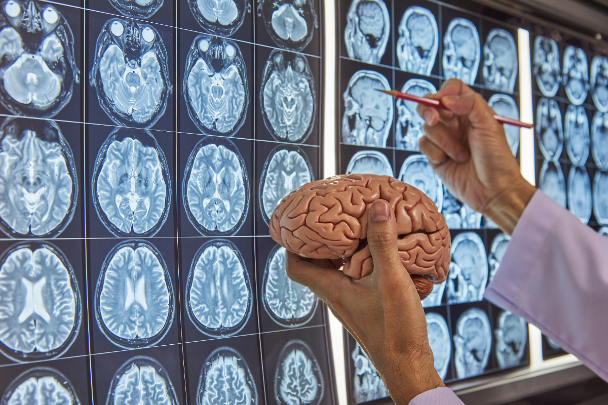 médico especialista em saúde mental verificando exame